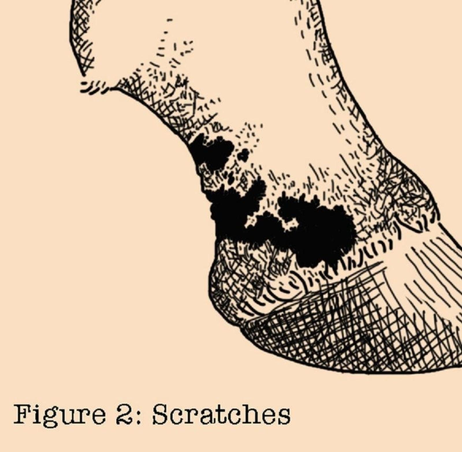 Figure-2-Scratches-Skin-Conditions